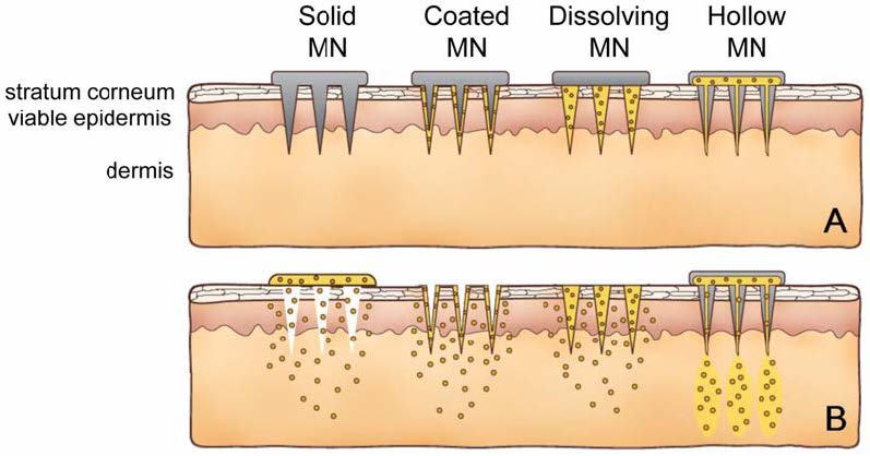 Figure 5.5 Working principle of micro-needle