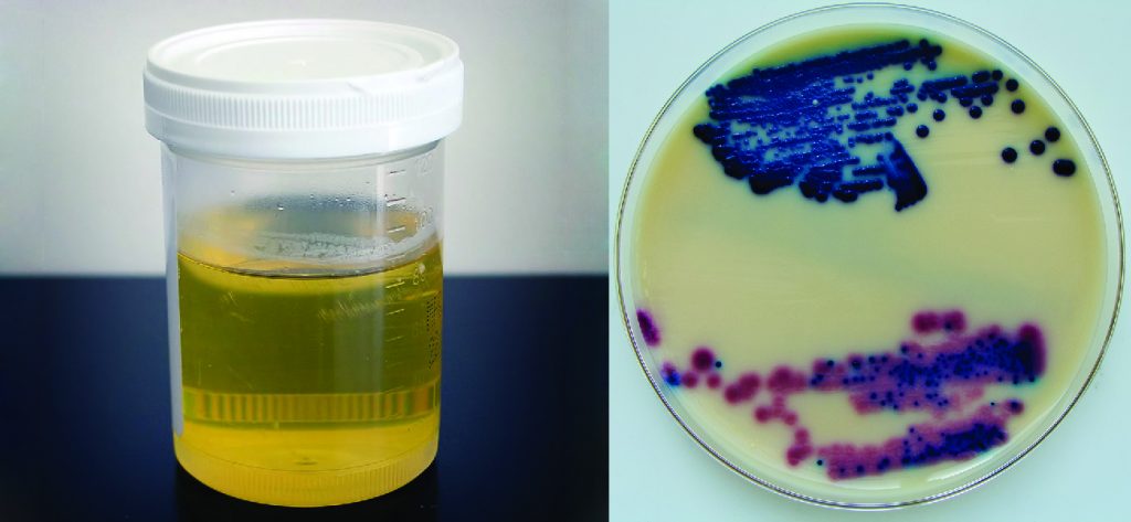 a small container filled with urine is shown on the left. The picture on the right shows a disc with a peach coloured film that is spotted with red and blue spots.