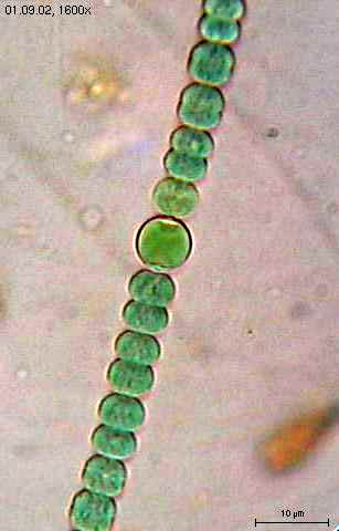 A photograph of a chain of green cells from Anabaena sperica. In the middle of the chain is an enlarged cell that is the heterocyst.