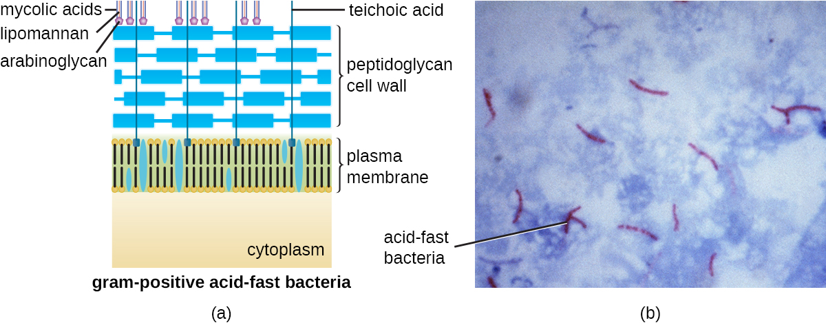 A) A diagram of acid-fast bacteria. B) A micrograph of acid-fast stained mycobacterial cells.