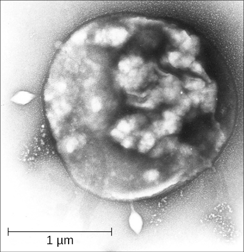 A micrograph of a spherical cell with diamond-shaped structures inside it and spindle shaped viruses being released from the surface.