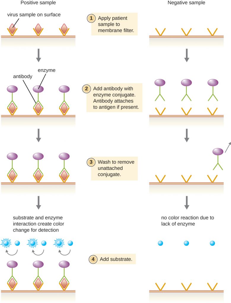 A diagram depicting the steps of an EIA for viral antigens.
