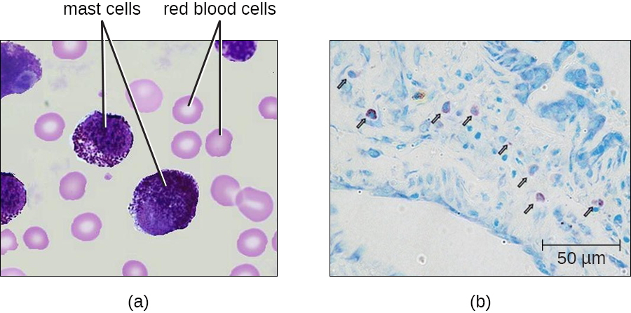 a) Mast cells in blood. Mast cells are large purple cells, red blood cells are small pink cells with a clear centre. b) mast cell outside of blood.
