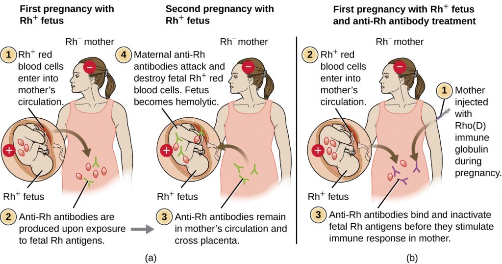 Diagram depicting the results of an Rh- mother experiencing two pregnancies with Rh+ fetuses.