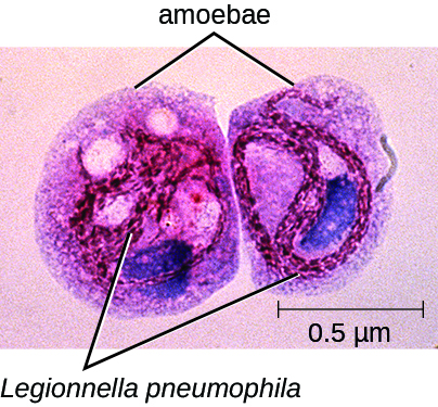 Micrographs of Legionella pneumophila infecting amoebae from a contaminated water sample