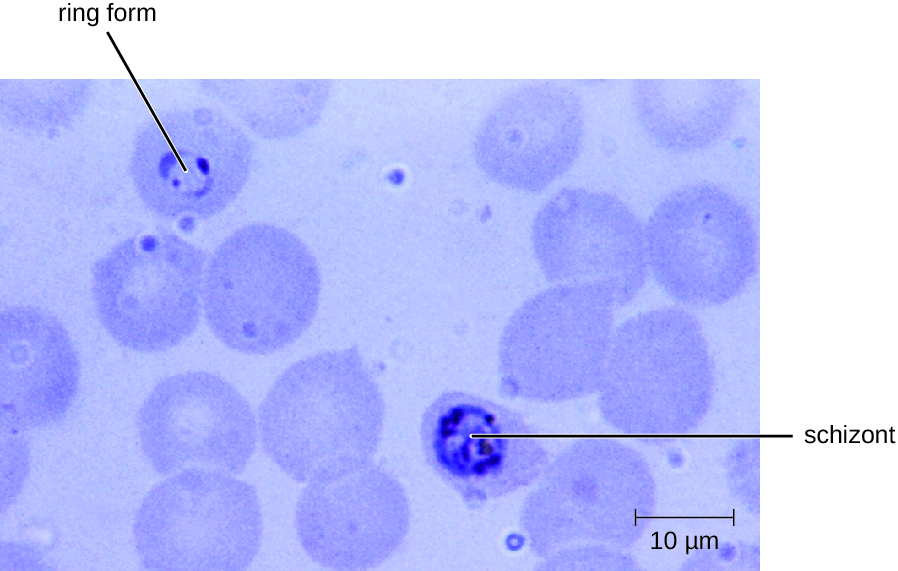 A micrograph showing red blood cells. A dark ring in the centre of one cell is labeled ring form. A larger dark region in another cell is labeled schizont.
