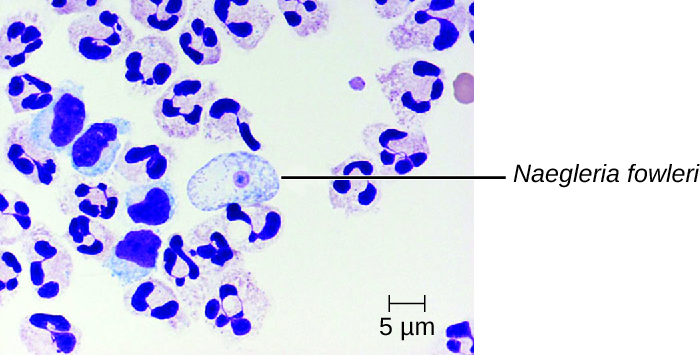 Micrograph of white blood cells and a large cell with a small round body in the centre labeled N. fowlerii.
